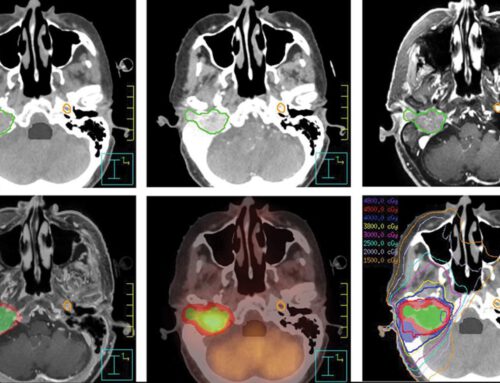 Casos de Éxito en Medición de Radiaciones (I)